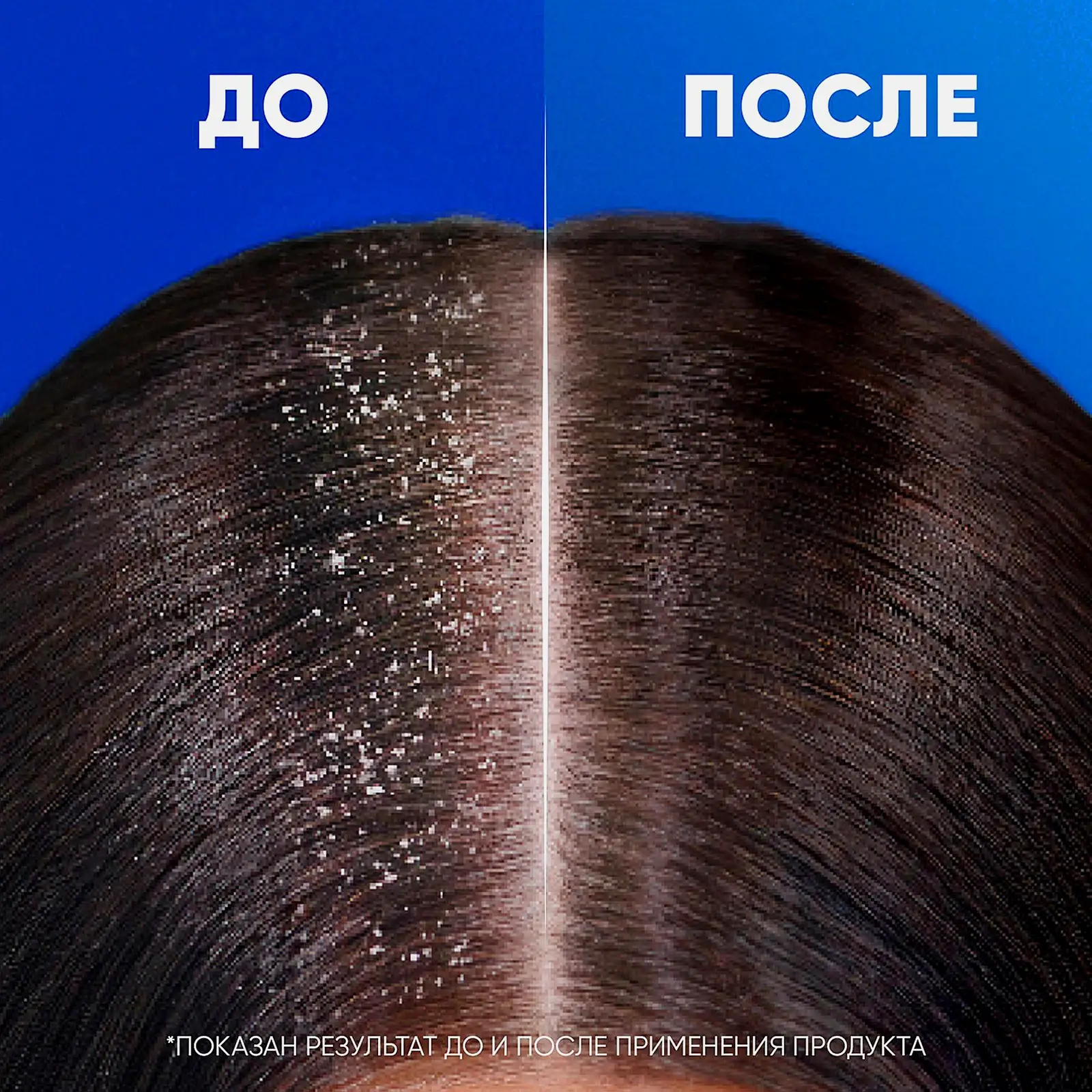 Шампунь для волос Head&Shoulders Увлажняющий уход 400мл - фото 7