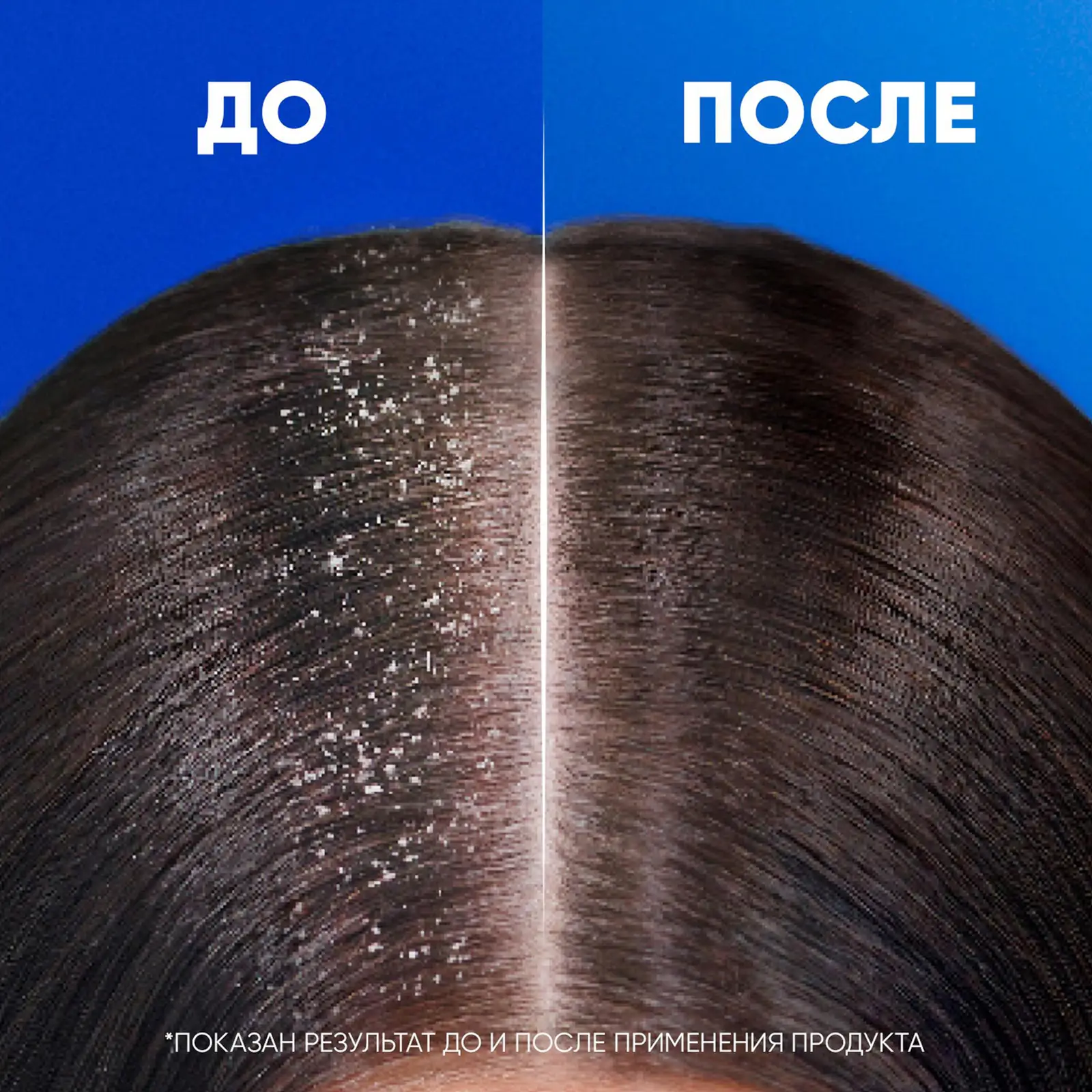 Шампунь для волос Head&Shoulders Лед арктики ментол 400мл
